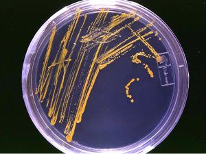 Solid agar plate with bacterial colonies