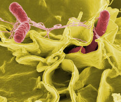 Color-enhanced scanning electron micrograph showing Salmonella typhimurium (red) invading cultured human cells.