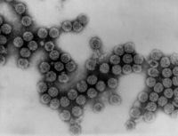 An electron micrograph of multiple polyomavirus virions