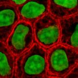 Cells in culture, stained for keratin (red) and DNA (green).