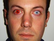 A man seen wearing two different styles of cosmetic contact lenses