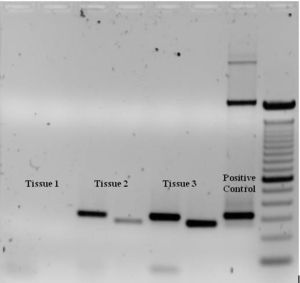 Gel electrophoresis image of a standard PCR.  Two sets of specific primers were used to amplify one gene from three seperate tissues.  As the gel shows, Tissue #1 lacks that gene, whereas Tissue #2 and #3 possess that gene.
