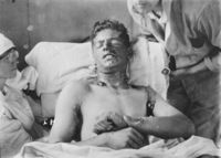 A soldier with mustard gas burns, ca. 1914-1918.