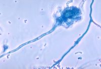 Aspergillus fumigatus - A common fungus which can lead to worsening lung disease in people with CF.