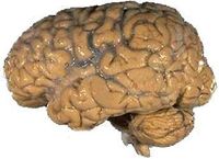 The human brain.