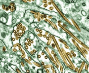 The A H5N1 virus, which cases Avian flu