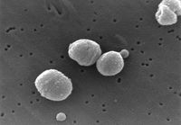 The bacterium Streptococcus pneumoniae, a common cause of pneumonia, photographed through an electron microscope.