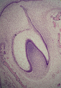 Histologic slide of tooth in early bell stage.  Note cell organization.