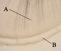 Cross-section of tooth at root. Note clear, acellular appearance of cementum.A: dentinB: cementum