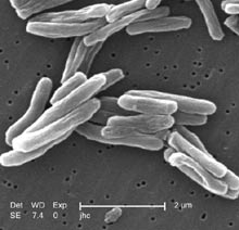 Scanning electron micrograph of Mycobacterium tuberculosis.