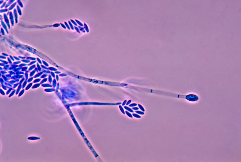 Image:Fusarium verticillioides 01.jpg
