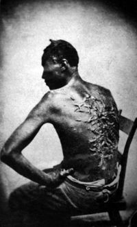 Whipped slave, Baton Rouge, Louisiana, April 2, 1863. 