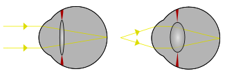 Light from a single point of a distant object and light from a single point of a near object being brought to a focus by changing the curvature of the lens.